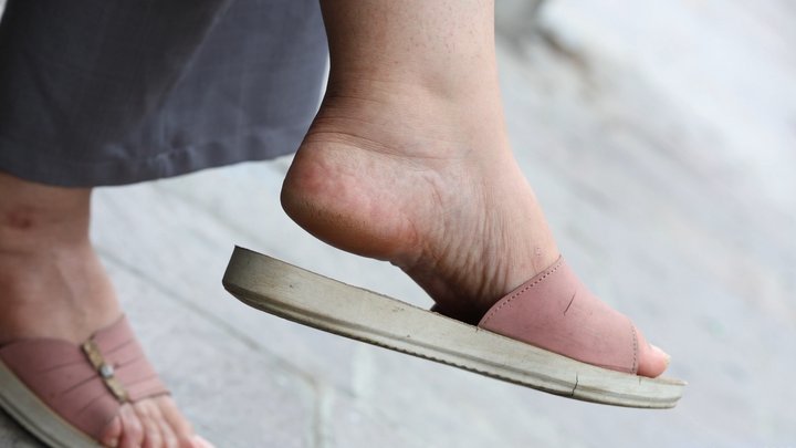 Slippers dangling, cracked heels, foot fetish admiratrion